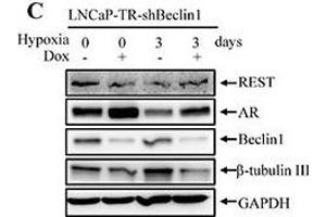 Western Blotting (WB) image for anti-Glyceraldehyde-3-Phosphate Dehydrogenase (GAPDH) antibody (ABIN2857072)