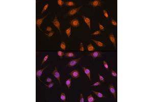 Immunofluorescence analysis of L929 cells using MB/MB/ML2 antibody (ABIN6132319, ABIN6143422, ABIN6143424 and ABIN6216232) at dilution of 1:100. (MAD2L2 Antikörper  (AA 1-211))