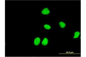 Immunofluorescence of monoclonal antibody to ZNF323 on HeLa cell.
