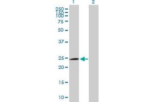 Western Blot analysis of FBXO42 expression in transfected 293T cell line by FBXO42 MaxPab polyclonal antibody. (FBXO42 Antikörper  (AA 1-716))