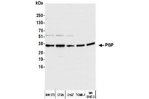 Western Blotting (WB) image for anti-Phosphoglycolate Phosphatase (PGP) (AA 271-321) antibody (ABIN7451551) (PGP Antikörper  (AA 271-321))