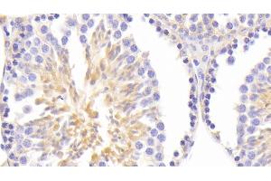 Detection of ASNS in Mouse Testis Tissue using Polyclonal Antibody to Asparagine Synthetase (ASNS) (Asparagine Synthetase Antikörper  (AA 213-561))