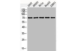 Western Blot analysis of 293T AD293 HELA HepG2 22RV1 cells using Phospho-c-Fos (S362) Polyclonal Antibody (c-FOS Antikörper  (pSer362))