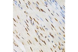 Immunohistochemistry of paraffin-embedded human colonic muscle using KPNA4 Antibody (ABIN5971058) at dilution of 1/200 (40x lens). (KPNA4 Antikörper)