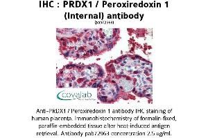 Image no. 1 for anti-Peroxiredoxin 1 (PRDX1) (Internal Region) antibody (ABIN1738319) (Peroxiredoxin 1 Antikörper  (Internal Region))