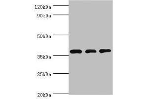 Western blot All lanes: STRAP antibody at 8 μg/mL Lane 1: HepG2 whole cell lysate Lane 2: Hela whole cell lysate Lane 3: Mouse brain tissue Secondary Goat polyclonal to rabbit IgG at 1/10000 dilution Predicted band size: 39, 40 kDa Observed band size: 39 kDa (STRAP Antikörper  (AA 1-350))