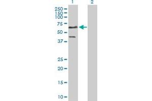 Western Blot analysis of ETS1 expression in transfected 293T cell line by ETS1 MaxPab polyclonal antibody.