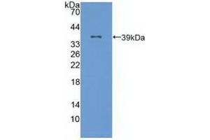 Detection of Recombinant ALOX12, Human using Polyclonal Antibody to Arachidonate-12-Lipoxygenase (ALOX12) (ALOX12 Antikörper  (AA 352-656))
