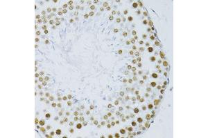 Immunohistochemistry of paraffin-embedded rat testis using SNRNP70 antibody. (SNRNP70 Antikörper  (AA 150-250))