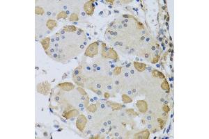 Immunohistochemistry of paraffin-embedded human stomach using ANAPC10 antibody at dilution of 1:100 (x40 lens). (ANAPC10 Antikörper)