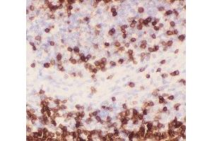 IHC-P staining of rat spleen tissue (CD3 epsilon Antikörper  (AA 23-207))