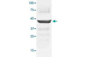 The tissue lysates derived from mouse liver were immunoblotted by MAP2K5 polyclonal antibody  at 1 : 1000. (MAP2K5 Antikörper  (C-Term))