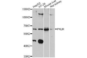 Western blot analysis of extracts of various cell lines, using PKLR antibody (ABIN5998532) at 1:3000 dilution. (PKLR Antikörper)