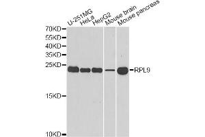 Western blot analysis of extracts of various cell lines, using RPL9 antibody. (RPL9 Antikörper)