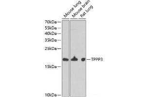 Western blot analysis of extracts of various cell lines using TPPP3 Polyclonal Antibody at dilution of 1:1000. (TPPP3 Antikörper)