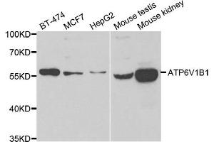 Western blot analysis of extracts of various cell lines, using ATP6V1B1 antibody. (ATP6V1B1 Antikörper)