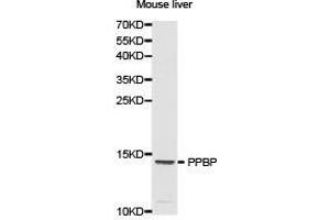 Western Blotting (WB) image for anti-Pro-Platelet Basic Protein (Chemokine (C-X-C Motif) Ligand 7) (PPBP) antibody (ABIN1874208) (CXCL7 Antikörper)