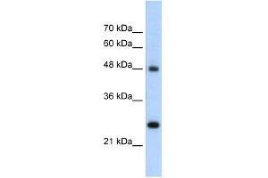 WB Suggested Anti-CHGA Antibody Titration:  5. (Chromogranin A Antikörper  (N-Term))