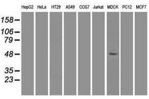 Image no. 2 for anti-Forkhead Box A1 (FOXA1) antibody (ABIN1498292) (FOXA1 Antikörper)