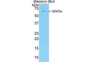 Western blot analysis of the recombinant protein. (ESM1 Antikörper  (AA 22-184))