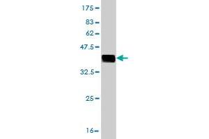 Western Blot detection against Immunogen (36. (CNOT3 Antikörper  (AA 1-100))