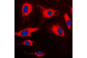 Immunofluorescent analysis of CARD14 staining in HeLa cells.