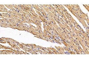 Detection of HIF1a in Rat Cardiac Muscle Tissue using Polyclonal Antibody to Hypoxia Inducible Factor 1 Alpha (HIF1a) (HIF1A Antikörper  (AA 216-336))