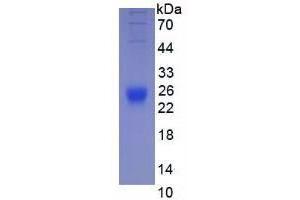 Image no. 1 for Interleukin 2 (IL2) (AA 21-169) (Active) protein (His tag) (ABIN5665851) (IL-2 Protein (AA 21-169) (His tag))