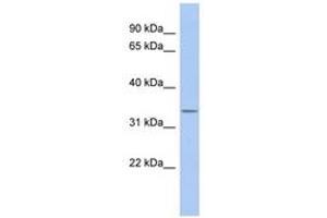 Image no. 1 for anti-Outer Dense Fiber of Sperm Tails 4 (ODF4) (N-Term) antibody (ABIN6743718) (ODF4 Antikörper  (N-Term))