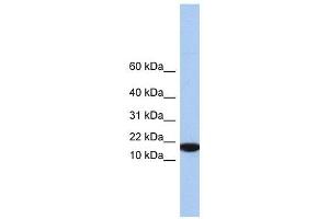 IL5 antibody used at 1 ug/ml to detect target protein.