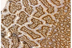 ABIN6259966 and ABIN6272936 at 1/100 staining Rat colon tissue by IHC-P. (AP3B1 Antikörper  (C-Term))