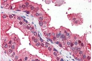Human Prostate (formalin-fixed, paraffin-embedded) stained with DRAM antibody ABIN351449 at 3 ug/ml followed by biotinylated goat anti-rabbit IgG secondary antibody ABIN481713, alkaline phosphatase-streptavidin and chromogen. (DRAM Antikörper  (N-Term))