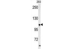 Western Blotting (WB) image for anti-Hypoxia Up Regulated 1 (HYOU1) antibody (ABIN3003137) (HYOU1 Antikörper)