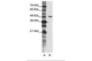 Image no. 1 for anti-Protein Phosphatase 1, Regulatory Subunit 8 (PPP1R8) (AA 91-140) antibody (ABIN202315) (PPP1R8 Antikörper  (AA 91-140))