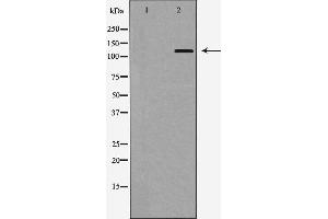 Western blot analysis of Integrin αE expression in HepG2 cells,The lane on the left is treated with the antigen-specific peptide. (CD103 Antikörper  (N-Term))