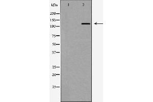Western Blotting (WB) image for anti-Integrin, alpha E (Antigen CD103, Human Mucosal Lymphocyte Antigen 1, alpha Polypeptide) (ITGAE) (N-Term) antibody (ABIN6262611)