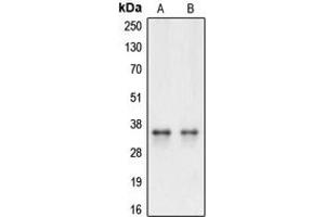 Western blot analysis of Caspase 3 expression in HeLa (A), Raw264. (Caspase 3 Antikörper  (Center))