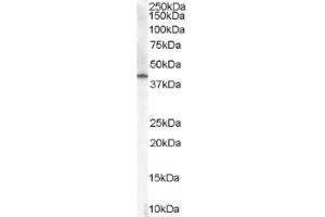 Image no. 2 for anti-Hydroxysteroid (11-Beta) Dehydrogenase 1 (HSD11B1) (C-Term) antibody (ABIN374673) (HSD11B1 Antikörper  (C-Term))
