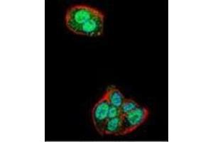 Confocal immunofluorescent analysis of Nucleolin Antibody (Center) Cat. (Nucleolin Antikörper  (Middle Region))