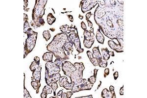 IHC analysis of DLAT using anti-DLAT antibody (ABIN7602307). (DLAT Antikörper  (AA 69-642))