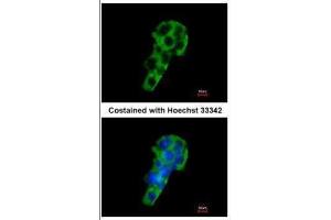 ICC/IF Image Immunofluorescence analysis of methanol-fixed HepG2, using PIGR, antibody at 1:200 dilution. (PIGR Antikörper)