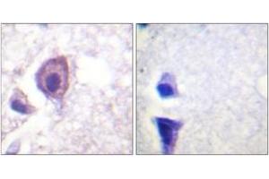 Immunohistochemistry analysis of paraffin-embedded human brain tissue, using CD4 (Ab-433) Antibody. (CD4 Antikörper  (AA 401-450))