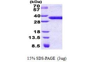 Yae1 Domain Containing 1 (YAE1D1) (AA 1-226) protein (His tag)