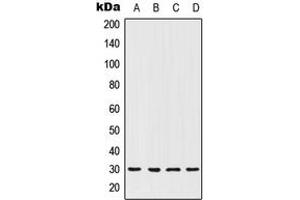 Western blot analysis of HOXC12 expression in MCF7 (A), ACHN (B), NIH3T3 (C), PC12 (D) whole cell lysates. (HOXC12 Antikörper  (Center))