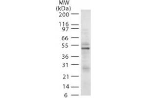 Image no. 1 for anti-E3 ubiquitin-protein ligase RAD18 (RAD18) (AA 402-414) antibody (ABIN208024) (RAD18 Antikörper  (AA 402-414))