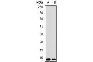 Western blot analysis of UBCH5 expression in SW620 (A), BT474 (B) whole cell lysates. (UBE2D1 Antikörper)