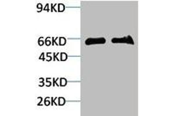 SLC6A1 Antikörper