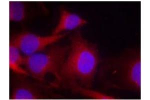 Image no. 2 for anti-Phospholipase C gamma 2 (PLCG2) (Tyr753) antibody (ABIN197402)