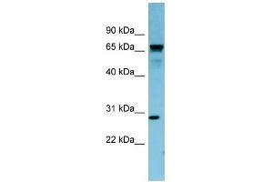 WB Suggested Anti-RASL12 Antibody Titration: 0. (RASL12 Antikörper  (N-Term))