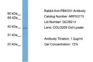 WB Suggested Anti-FBXO31  Antibody Titration: 0. (FBXO31 Antikörper  (Middle Region))